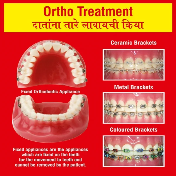 Ortho treatment in Andheri | Ortho treatment in Mumbai | Dental Treatment in Mumbai